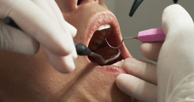Dentist Canberra
